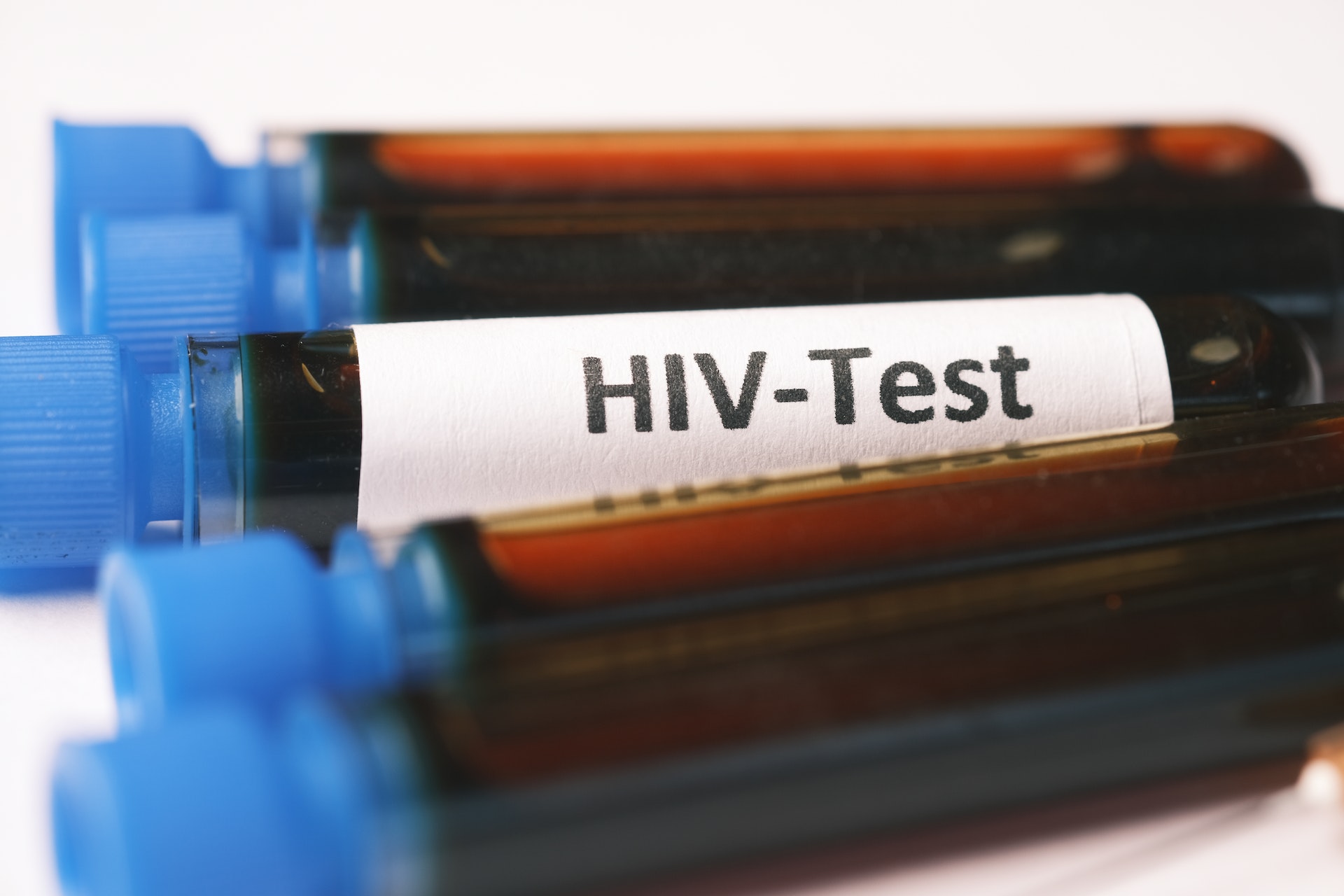 hiv testing